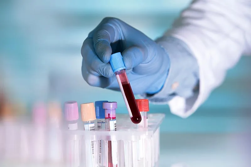 Platinum Blood Test Package result