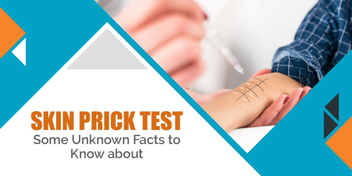 Everything You Should Know About Skin Prick Test